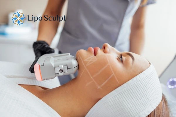 HIFU vs Botulinum Toxin: Understanding the Differences 1 HIFU vs Botox Moss Side What is the best option for you?