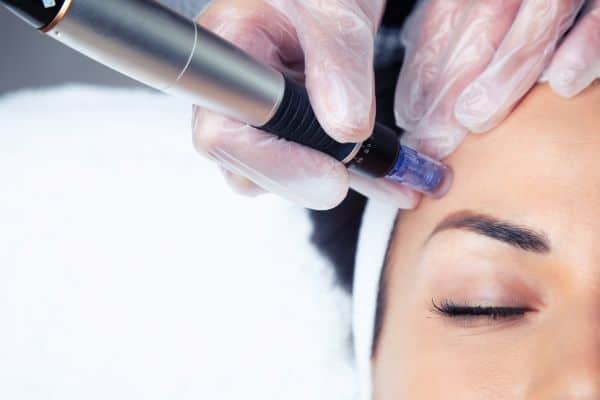 Explaining Total Skin Tightening Treatment and What to Expect 2 What Skin Concerns Can Total Skin Tightening Treatment Help With Moss Side?